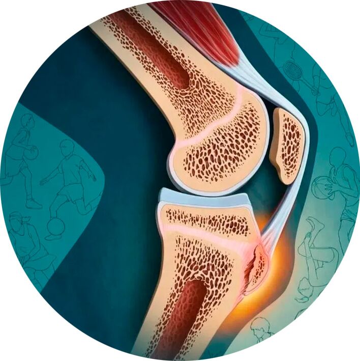 A estrutura da articulación e os tecidos circundantes