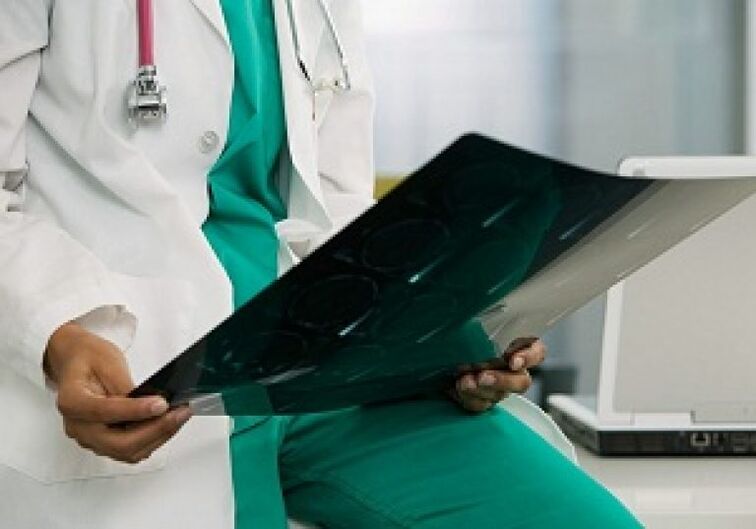 A radiografía axudará ao médico a diagnosticar osteocondrose da columna torácica