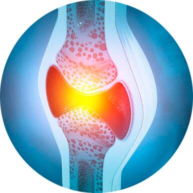 proceso de restauración articular con gel Icexin